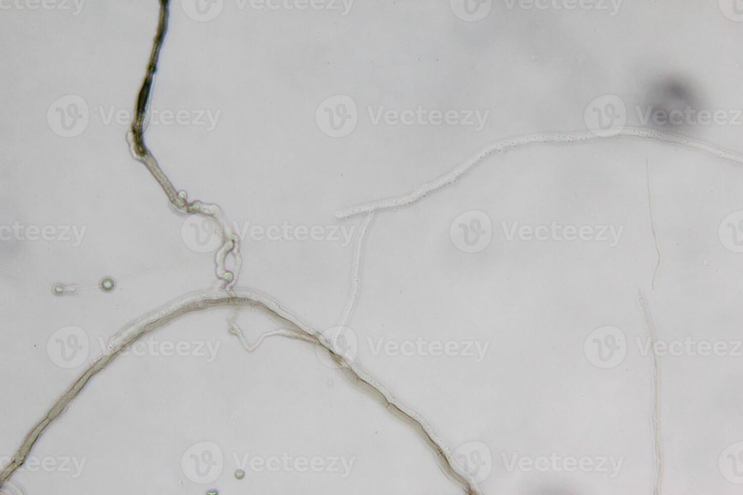 Penicillium, ascomycetous fungi are of major importance in the natural environment as well as food and drug production. photo