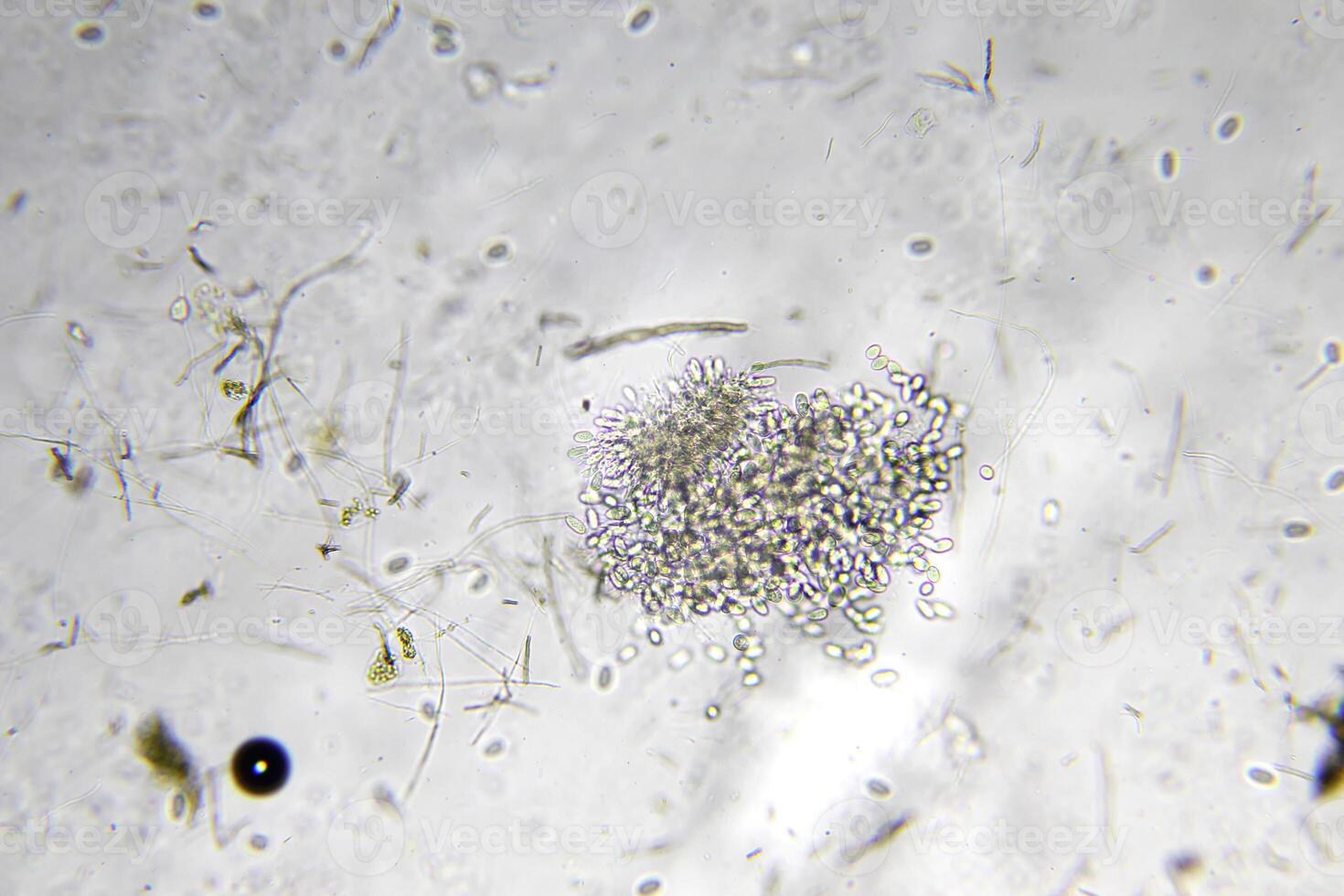 Penicillium, ascomycetous fungi are of major importance in the natural environment as well as food and drug production. photo
