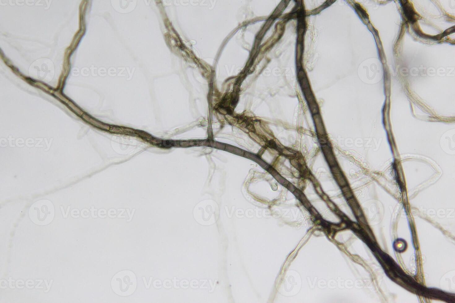 Penicillium, ascomycetous fungi are of major importance in the natural environment as well as food and drug production. photo