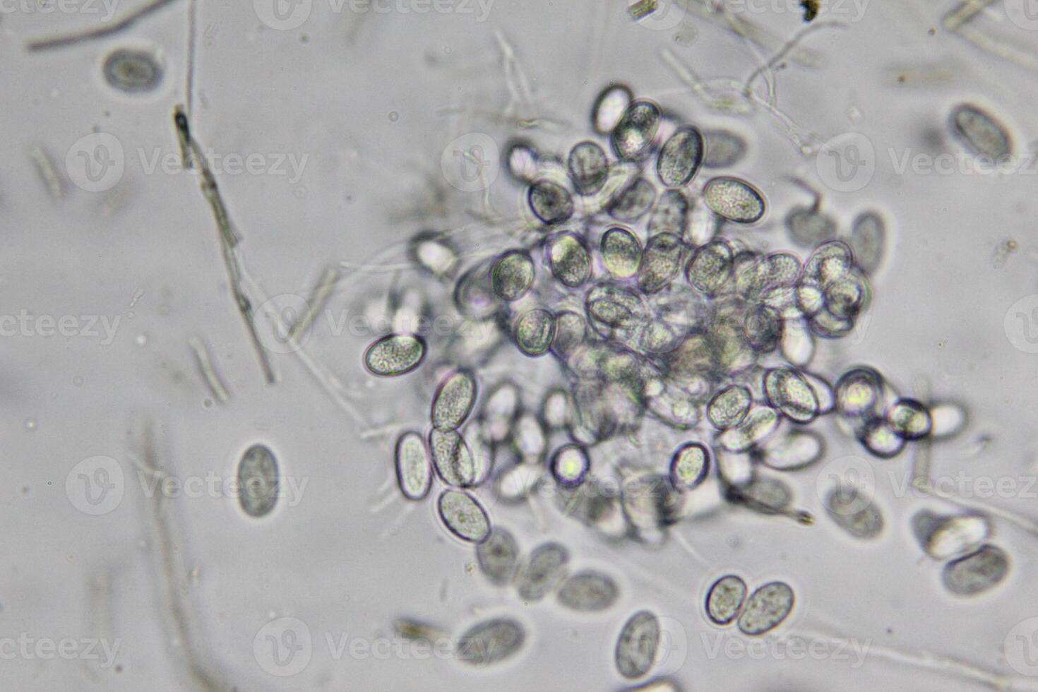 Penicillium, ascomycetous fungi are of major importance in the natural environment as well as food and drug production. photo