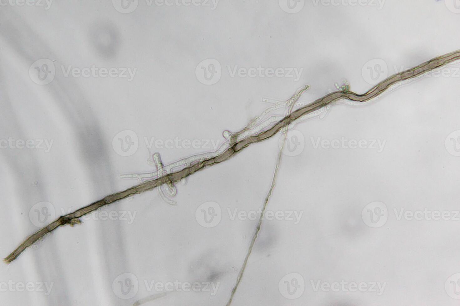 Penicillium, ascomycetous fungi are of major importance in the natural environment as well as food and drug production. photo