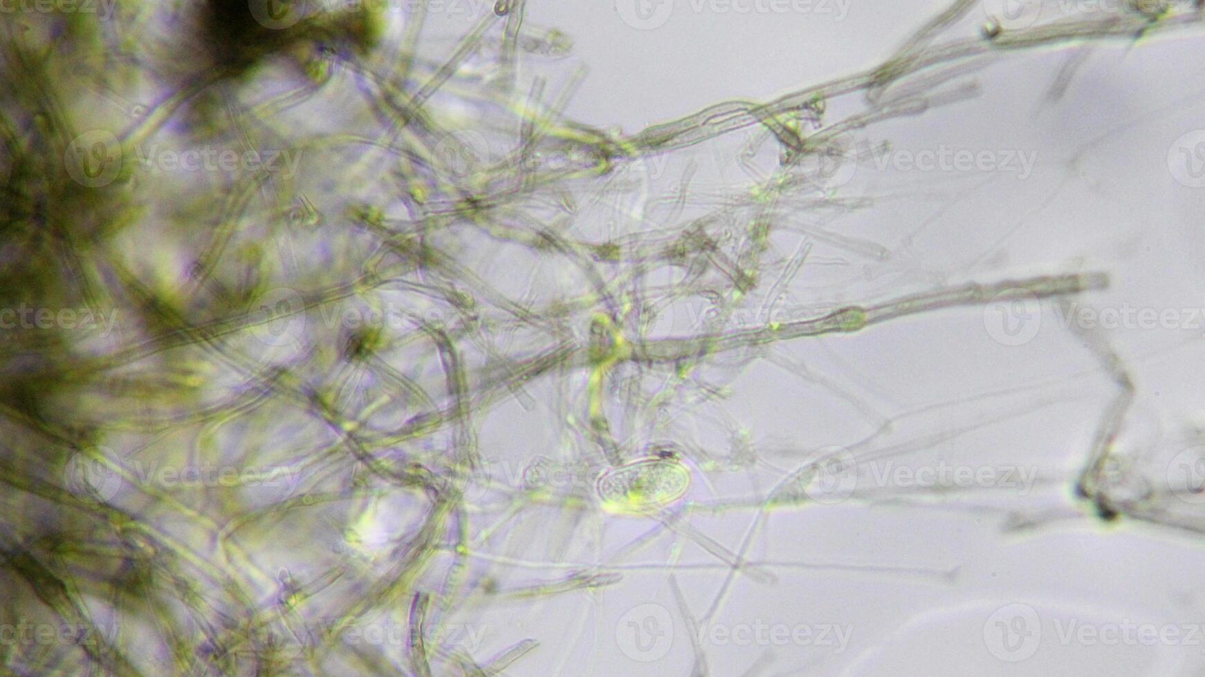 Penicillium, ascomycetous fungi are of major importance in the natural environment as well as food and drug production. photo