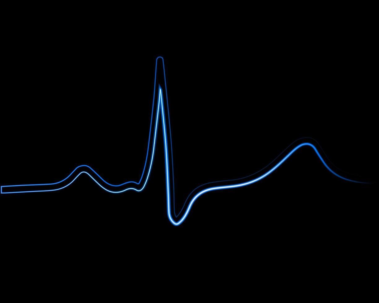 Illustration of electrocardiogram with neon effect. vector