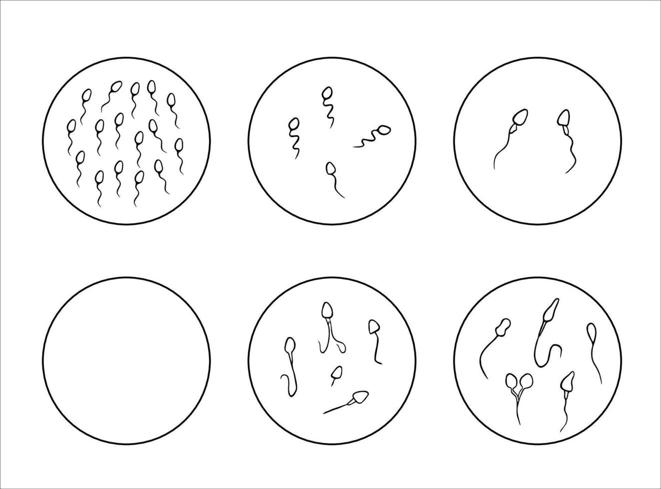 Illustration of sperm pathologies. Spermogram. Sperm defects. Defects of the sperm head. Sperm motility. vector