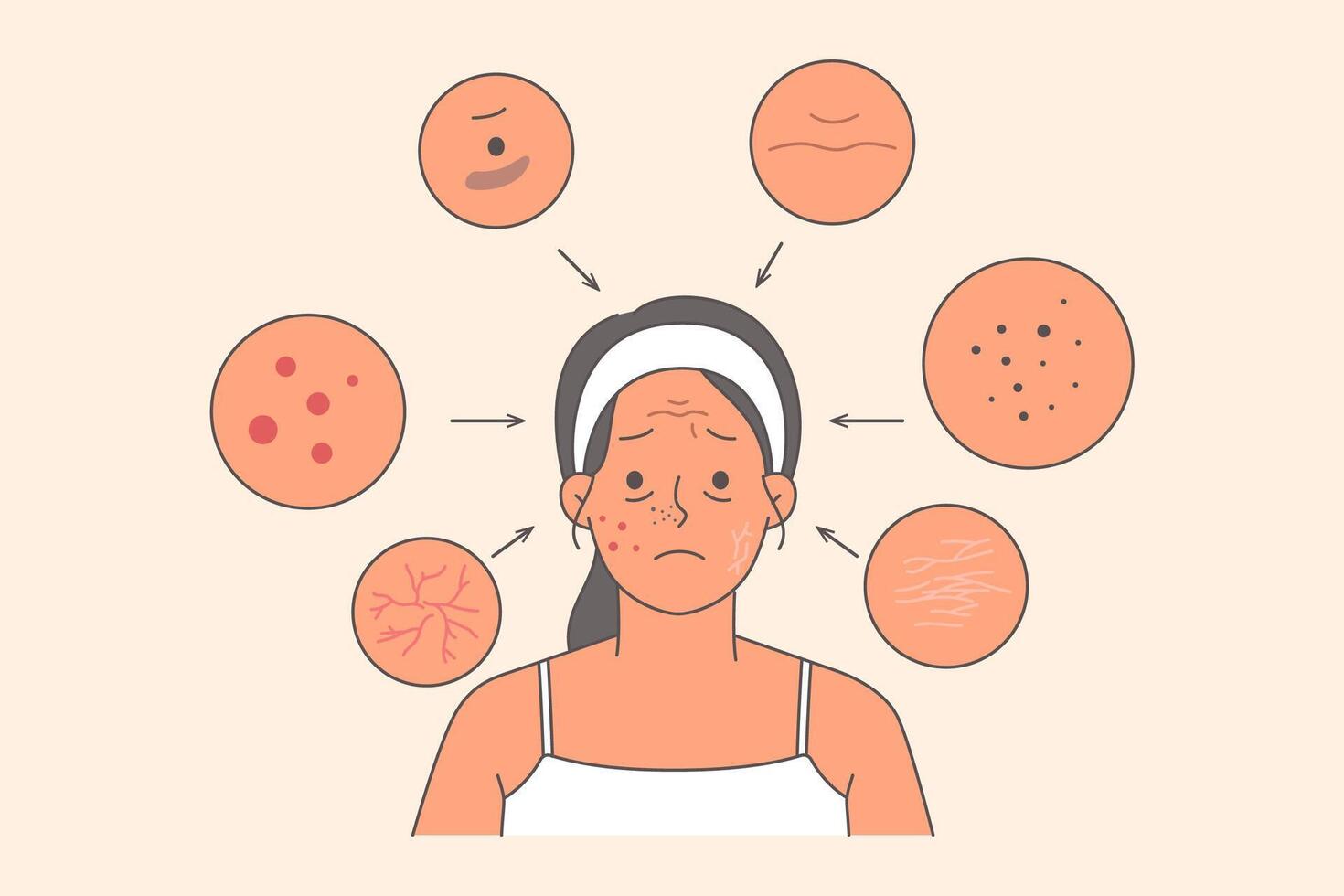 Woman with acne and wrinkles on face or cracks in dry skin needs help of cosmetologist vector