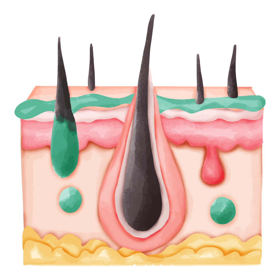 Watercolor Illustration of Hair Follicle with Sebum and Pus png
