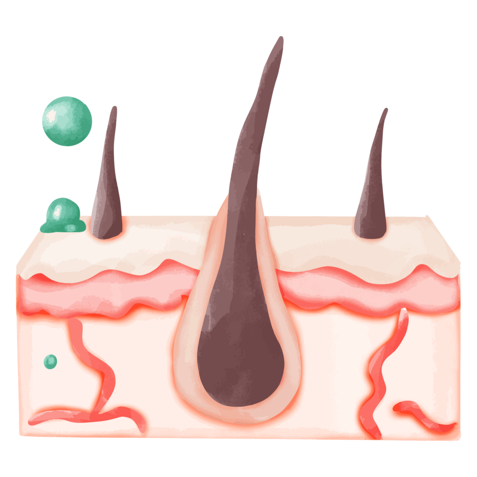 Watercolor Illustration of Hair Follicle with Bacterial Infection png