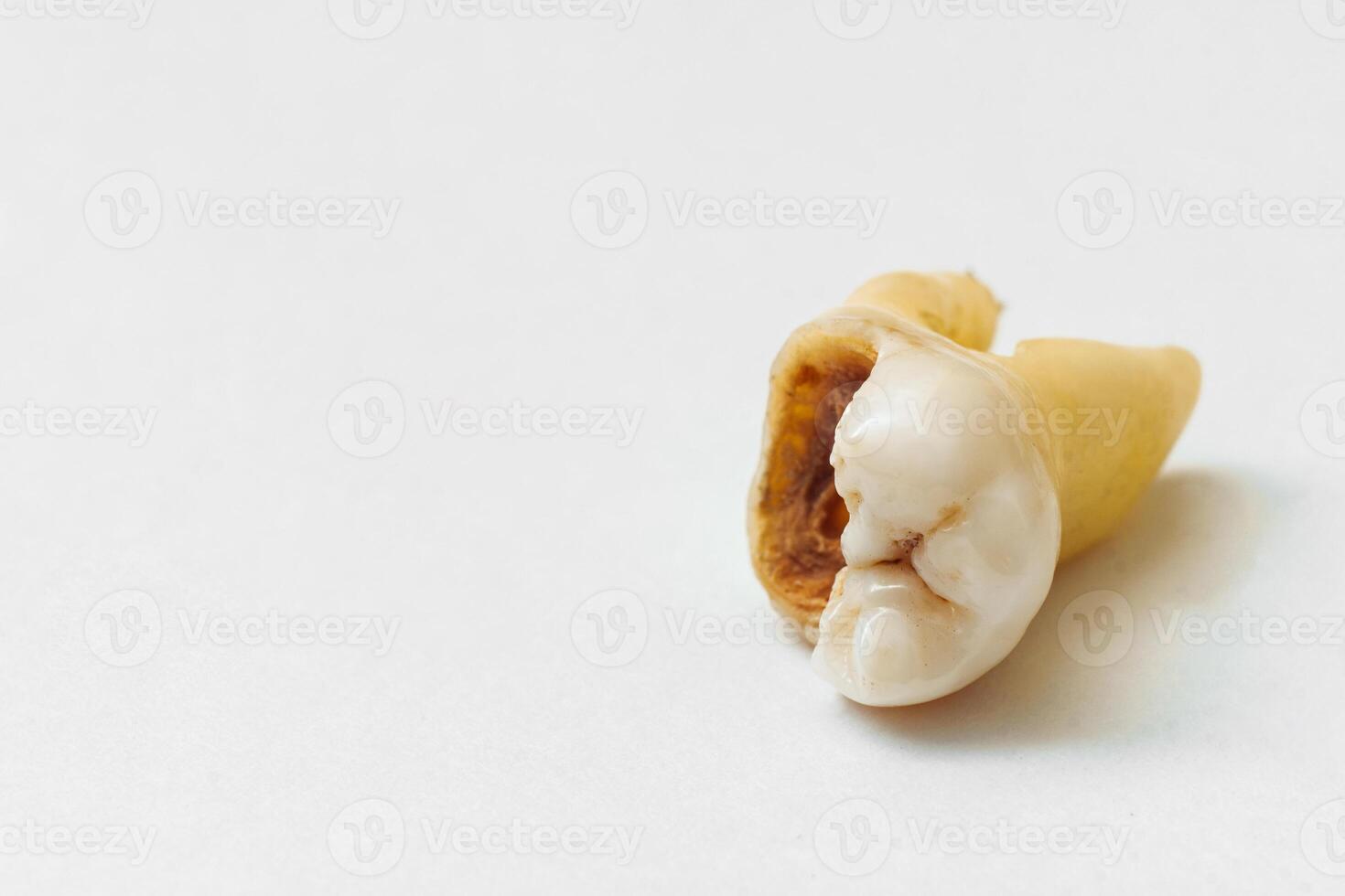 An old chipped tooth isolated on a white background. photo