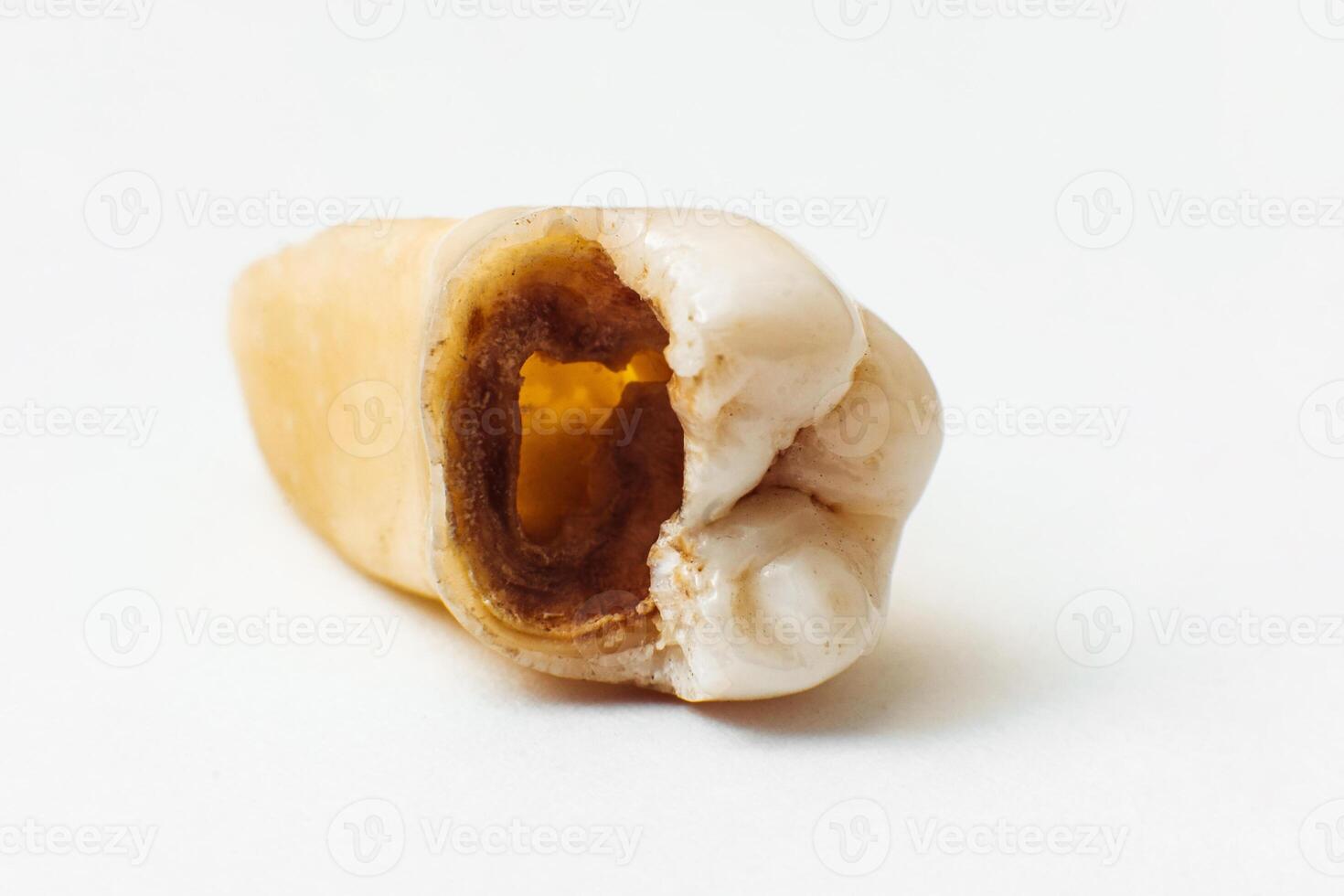 Macro photography of a tooth with cavities, hygiene and oral care concept. photo