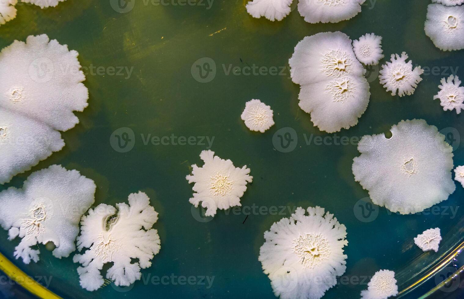Colonies of pathogenic bacteria in a Petri dish, microbiological studies photo