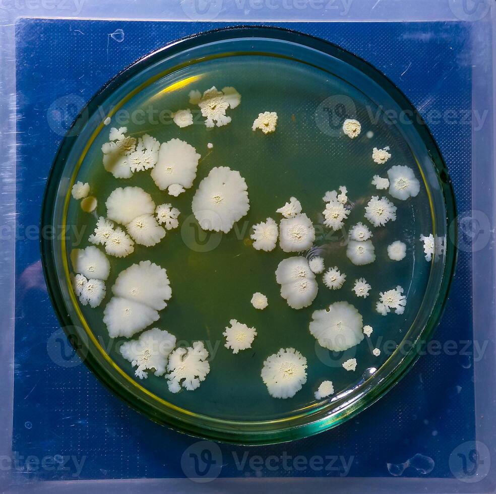 Colonies of pathogenic bacteria in a Petri dish, microbiological studies photo