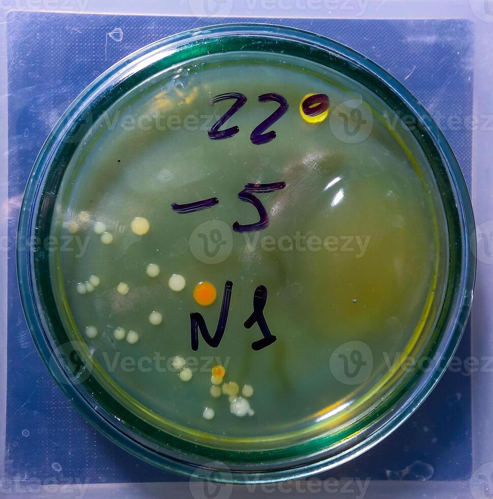 Colonies of pathogenic bacteria in a Petri dish, microbiological studies photo