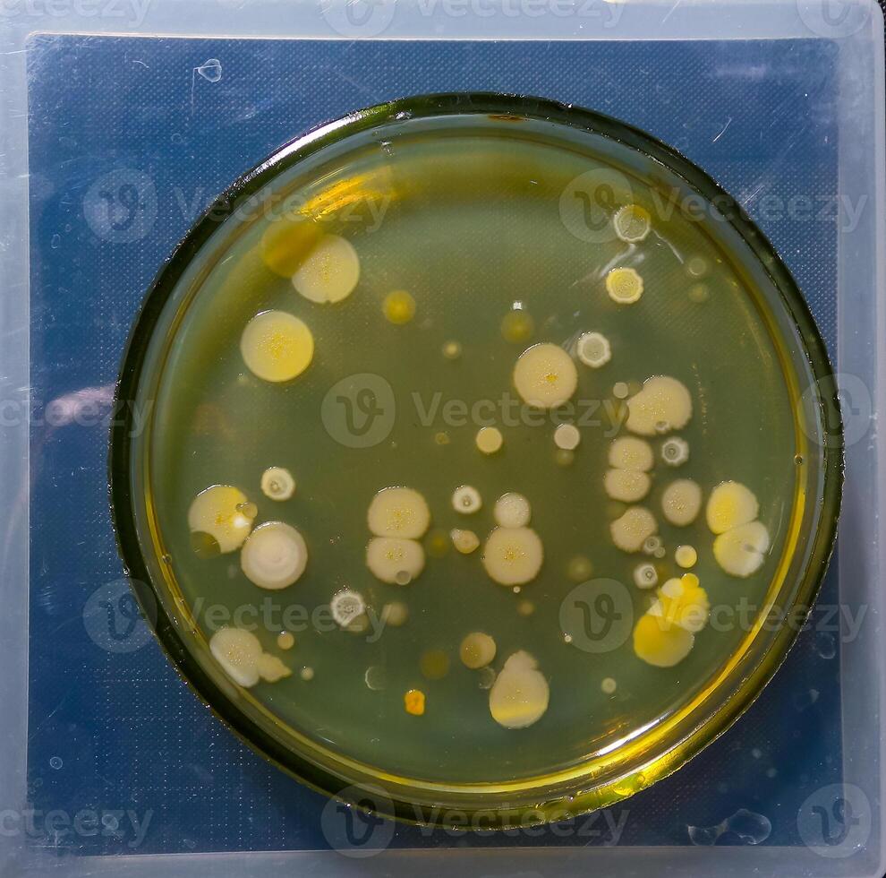 Colonies of pathogenic bacteria in a Petri dish, microbiological studies photo