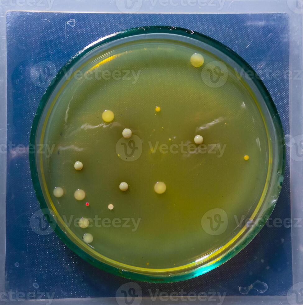 Colonies of pathogenic bacteria in a Petri dish, microbiological studies photo