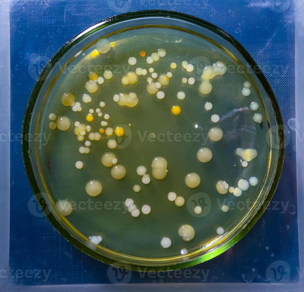 Colonies of pathogenic bacteria in a Petri dish, microbiological studies photo