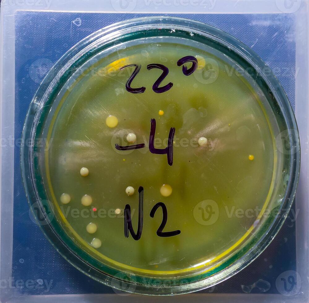 Colonies of pathogenic bacteria in a Petri dish, microbiological studies photo