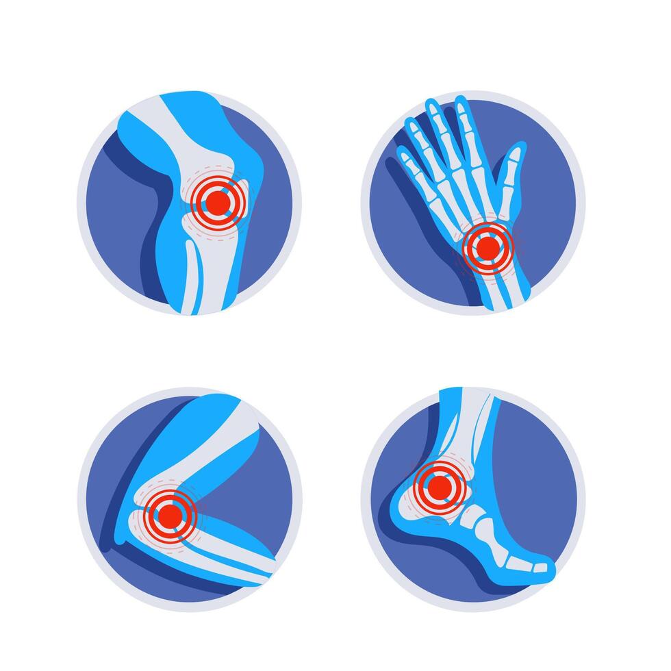 Set of joints pain icons showing symptoms of arthritis, osteoporosis, rheumatoid, gout, knee, wrist, elbow, ankle injury. vector