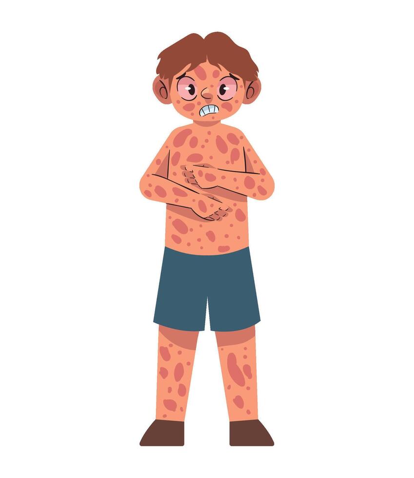 A man with a rash on his body vector