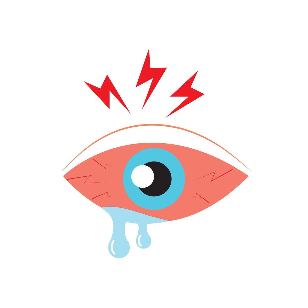 Eye sore color line icon, disease and allergy, eye redness, graphics, editable stroke filled outline sign vector