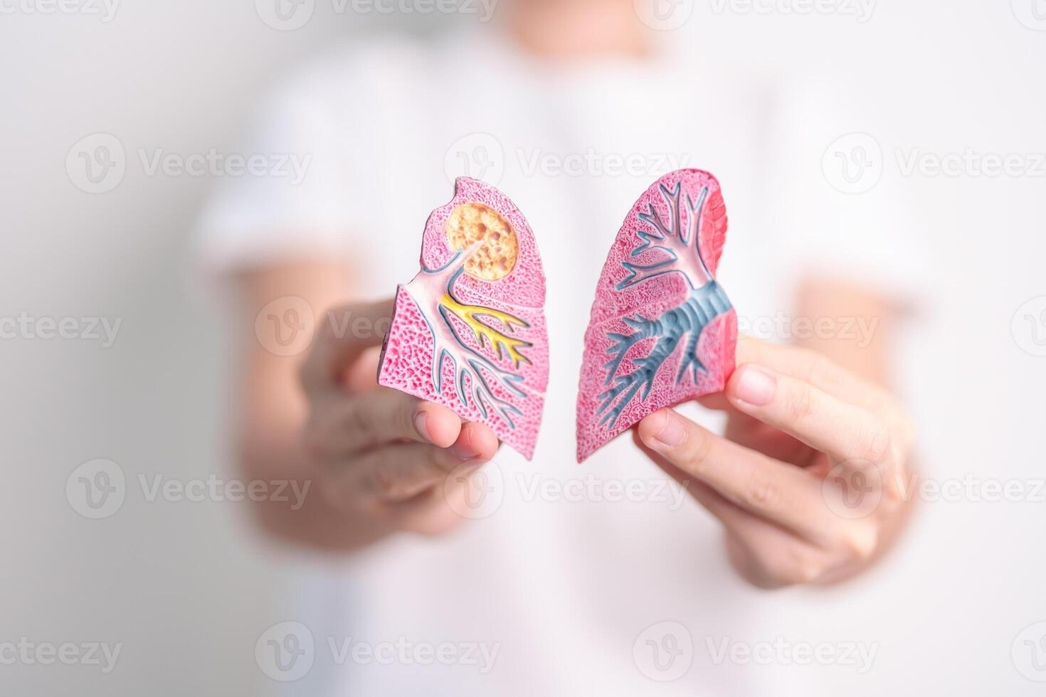 woman hold Smoker anatomy for Disease. Lung Cancer, Asthma, Chronic Obstructive Pulmonary or COPD, Bronchitis, Emphysema, Cystic Fibrosis, Bronchiectasis, Pneumonia and world Lung day concept photo