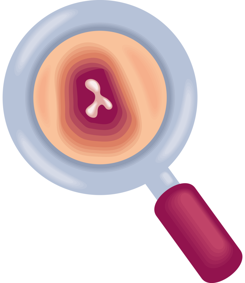 multiple myeloma bone marrow cancer png