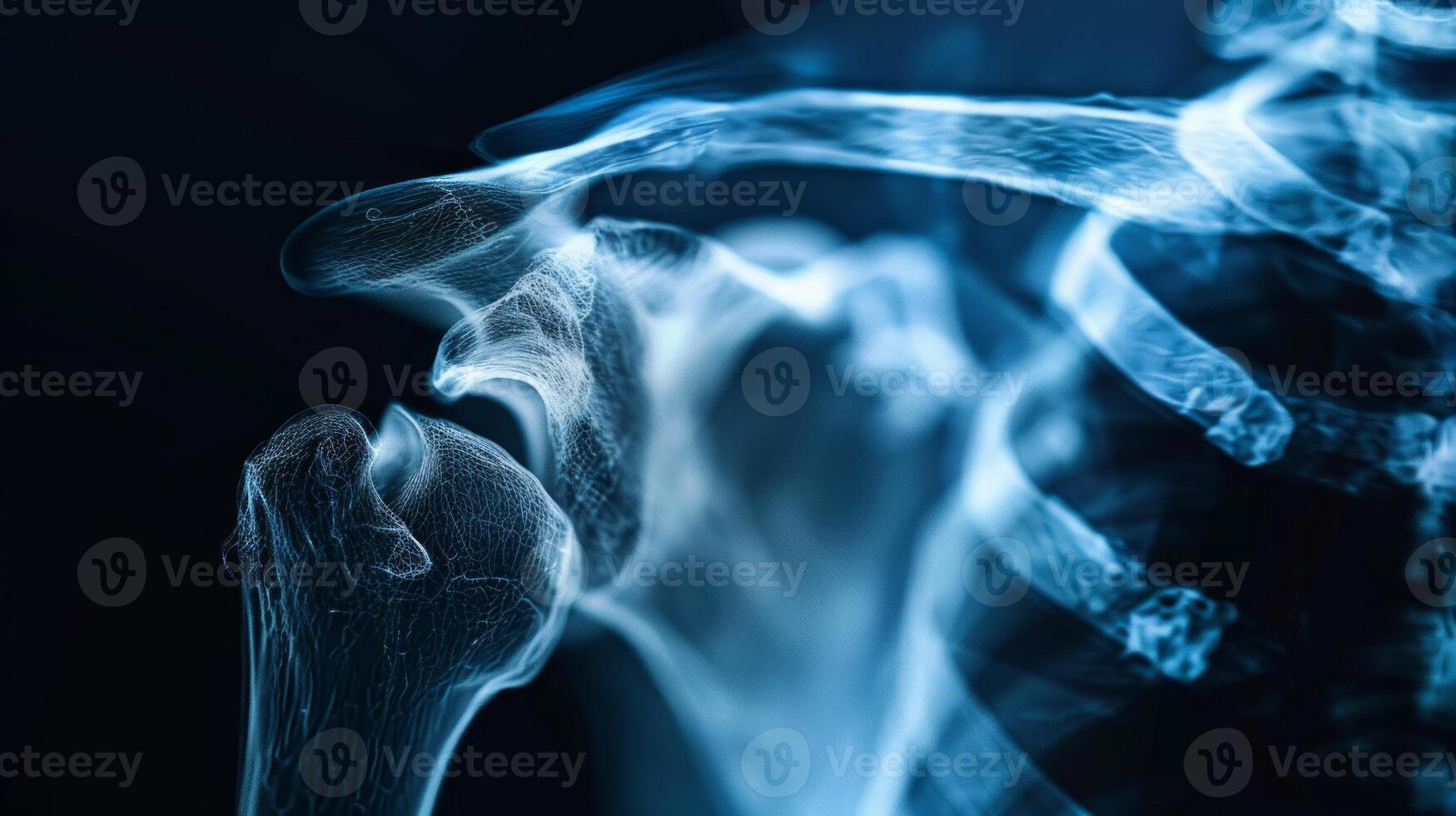 Detailed High-Resolution X-ray Image of Human Shoulder Joint and Rib Cage. Concept of Human Anatomy, Medical Imaging, Bone Structure, Orthopedics, scanning photo