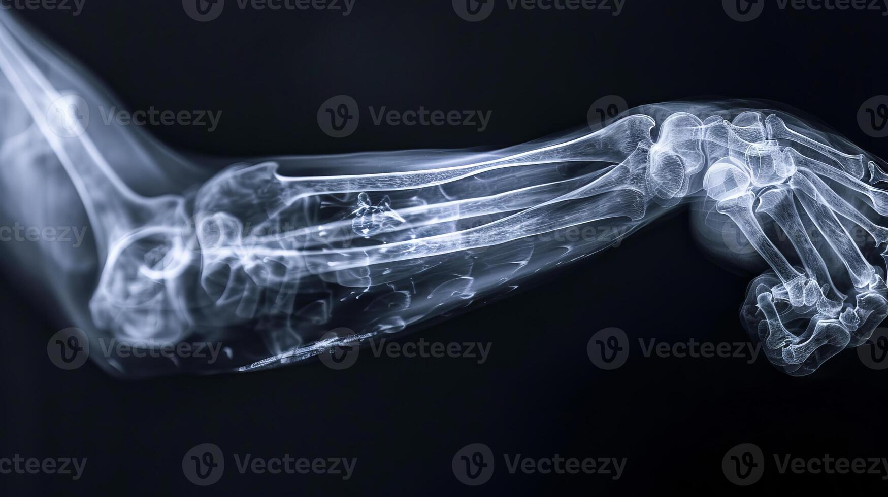 Intricate X-Ray Image of a Human Elbow Joint Highlighting Bone Structure and Details. Concept of Human Anatomy, Medical Analysis, Skeletal Study, Orthopedic Examination photo