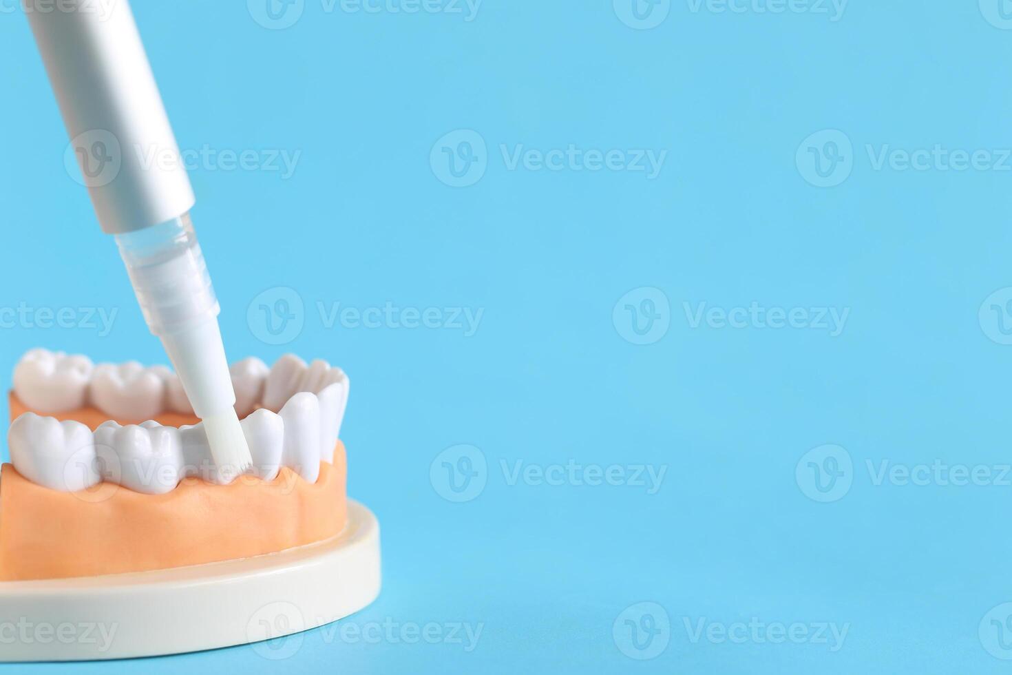 Home whitening, Tooth model with bleaching gel syringe for whitening teeth on blue background, Healthy teeth and Tooth hygiene concept photo