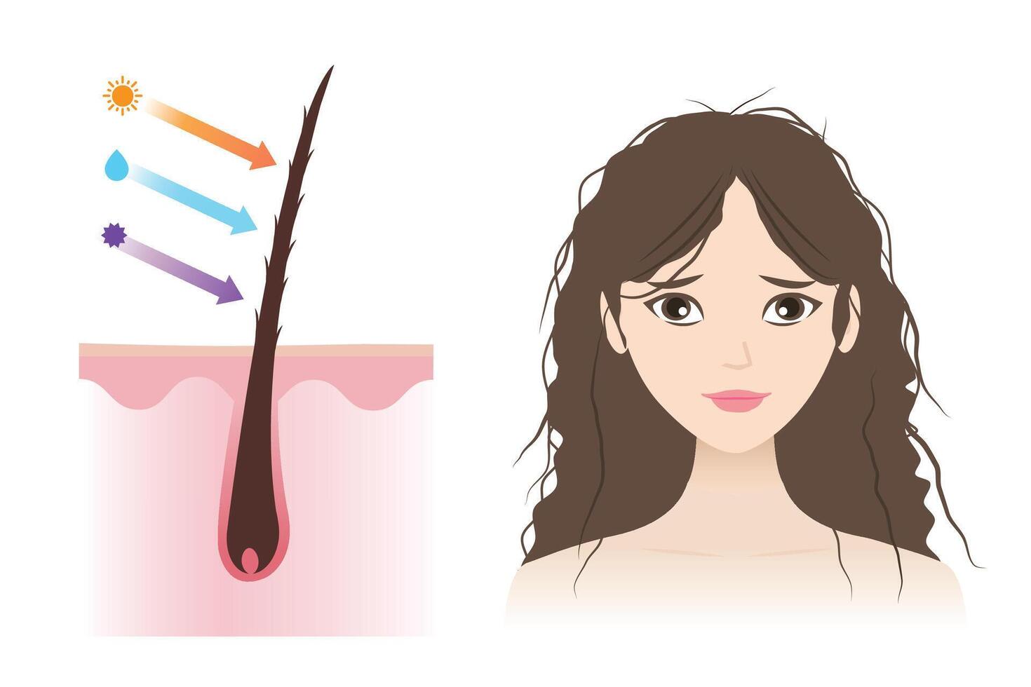 Infographic of open cuticle damaged hair illustration isolated on white background. The woman with dry, frizzy hair caused by ultraviolet, heat, moisture and toxic product. Hair care concept. vector