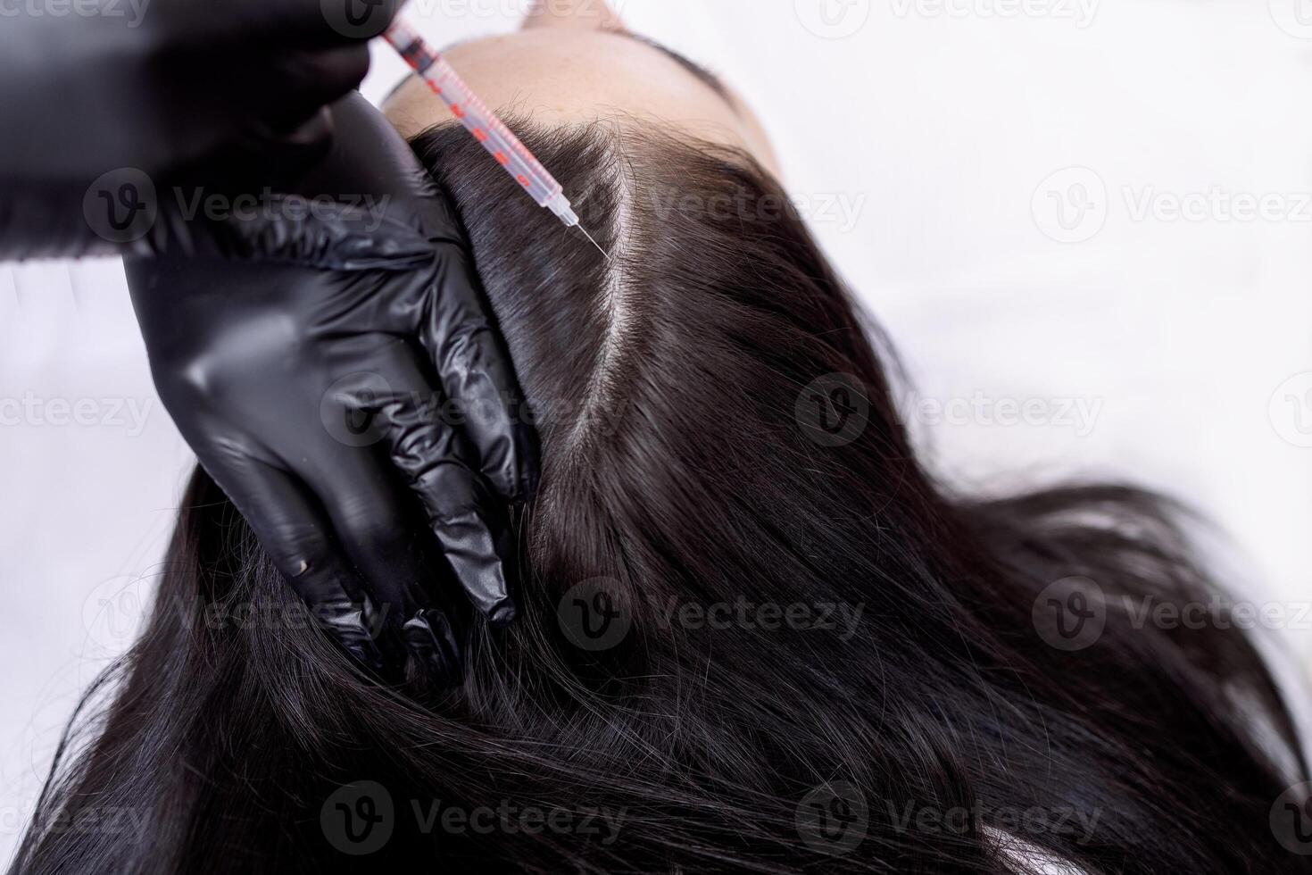 plasmolifting or PRP method point the introduction of the patient's own plasma photo