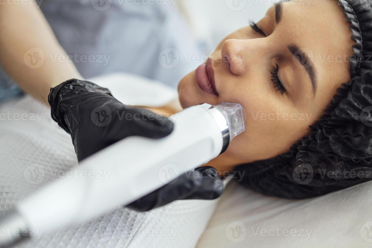 Microneedle RF lifting procedure. Hardware cosmetology. photo