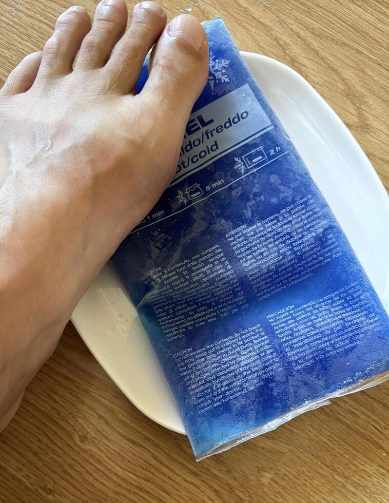 A foot rests on a blue gel ice pack placed on a white plate. The ice pack, used to reduce pain and swelling after a gout attack, shows condensation from being recently removed from the freezer. photo