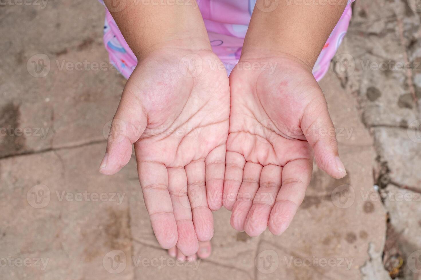 Girl's hands wrinkle pruney fingers after playing in the pool for a long time, young female palm wrinkles on fingers, top view photo