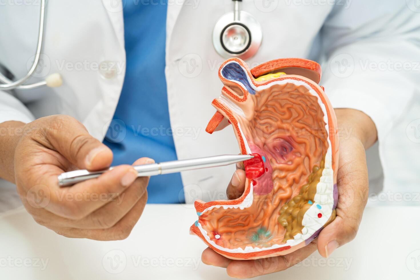 Cardiovascular disease CVD, Asian doctor holding human anatomy model for learn and treat heart disease. photo