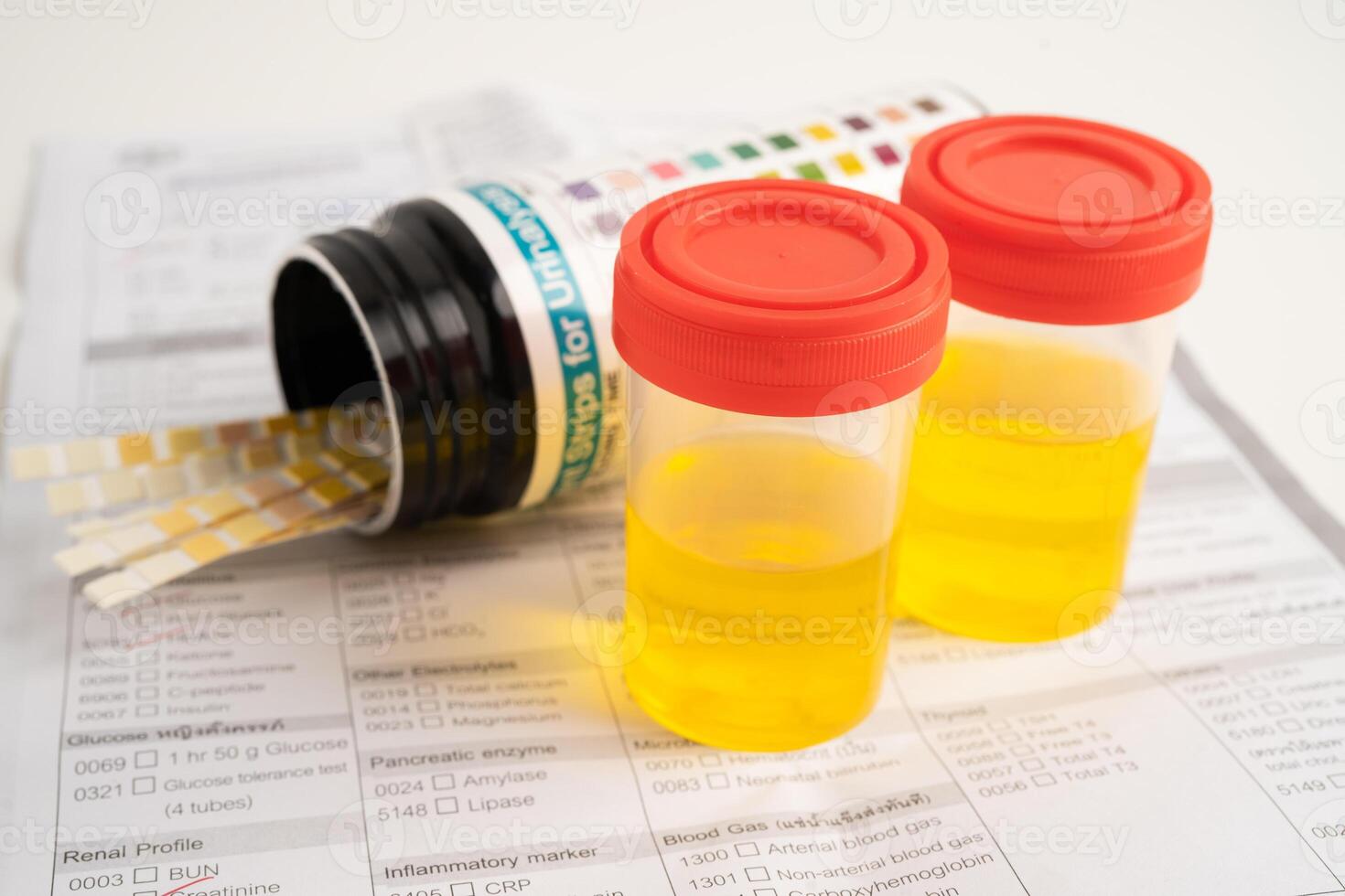 Urinalysis, urine cup with reagent strip pH paper test and comparison chart in laboratory. photo