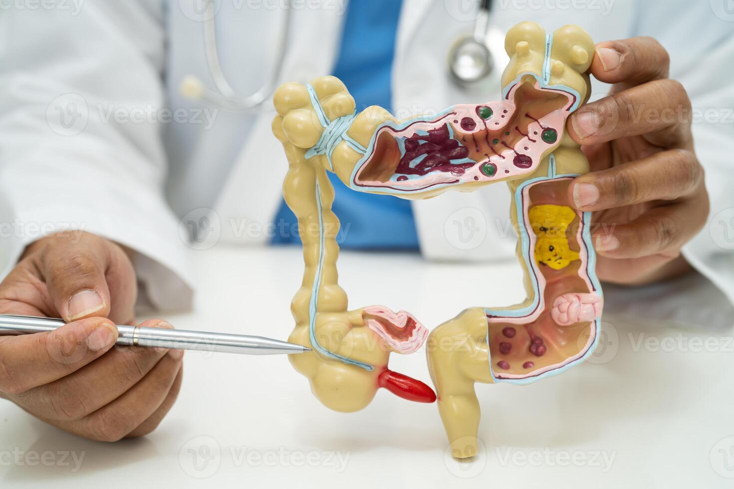 Intestine, appendix and digestive system, doctor holding anatomy model for study diagnosis and treatment in hospital. photo