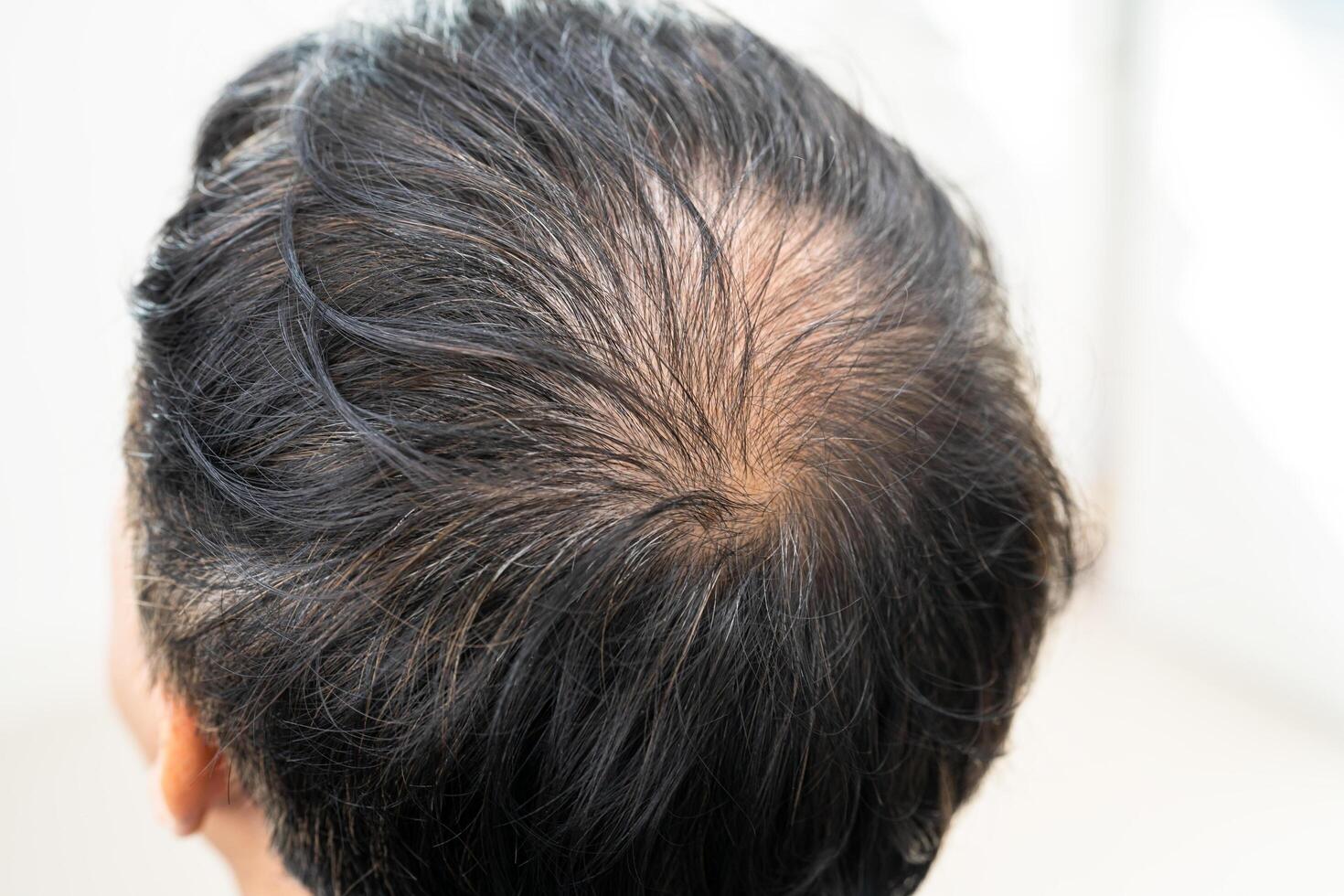 Bald in the middle head and begin no loss hair glabrous of mature Asian business smart active office man. photo