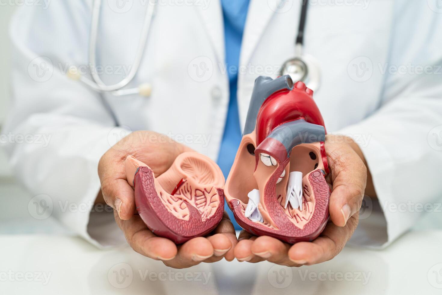 Cardiovascular disease CVD, Asian doctor holding human anatomy model for learn and treat heart disease. photo