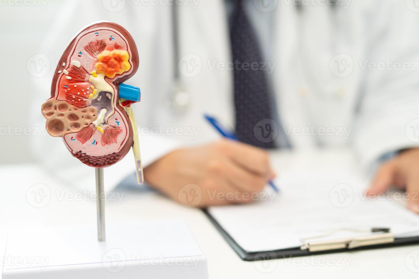 Kidney disease, Chronic kidney disease ckd, Doctor with human model to study and treat in hospital. photo