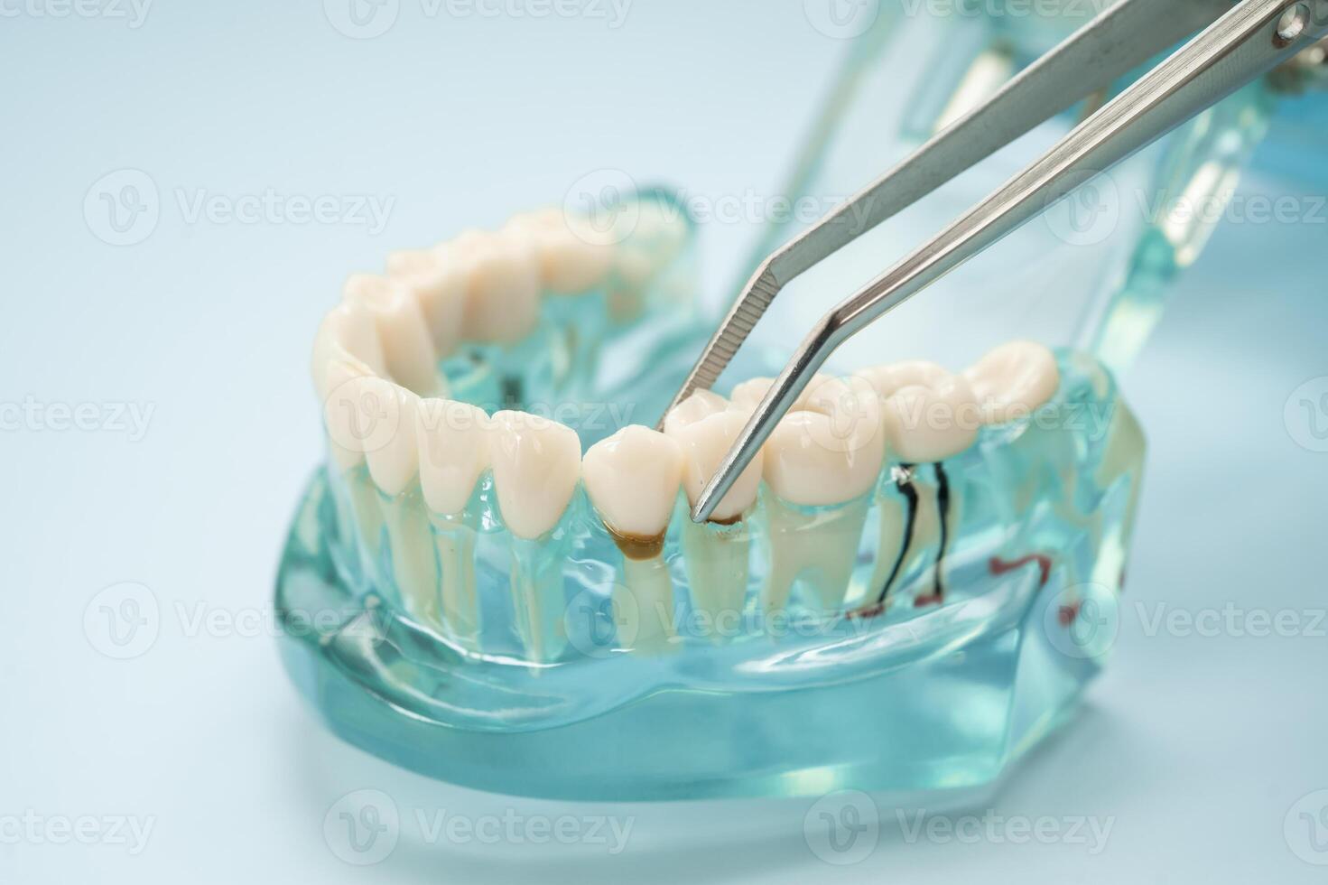 Dental teeth model with dentist tool for dentistry. photo