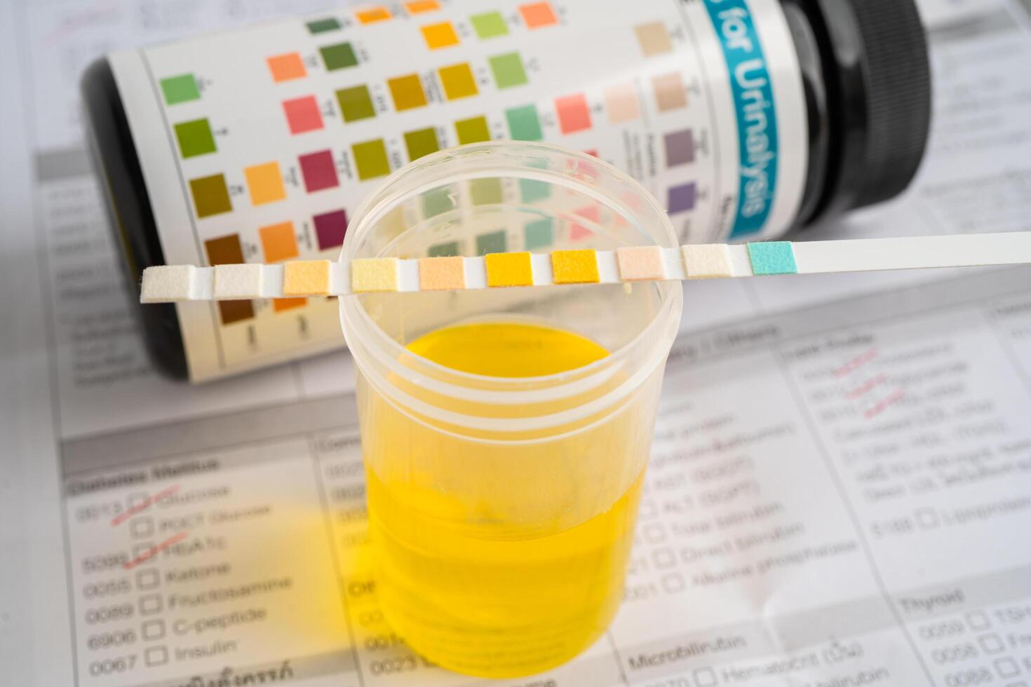 Urinalysis, urine cup with reagent strip pH paper test and comparison chart in laboratory. photo