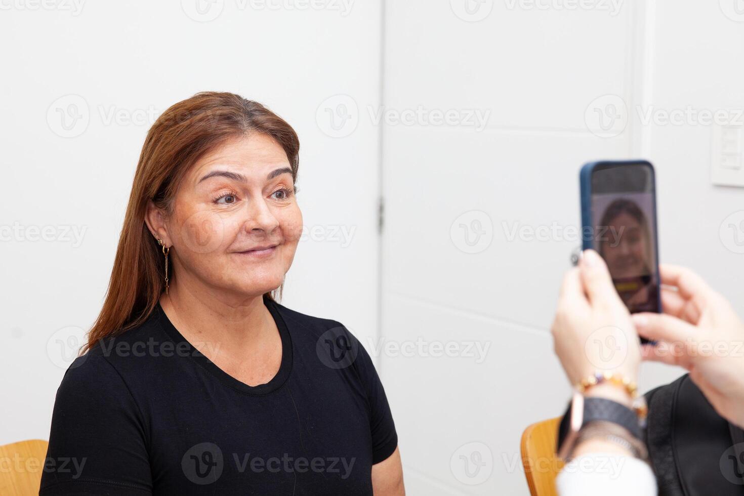 Expression of surprise. Photographic record. Dermatologist taking pictures to a middle age female patient prior to application of Botulinum toxin injections. Aesthetic medicine. photo