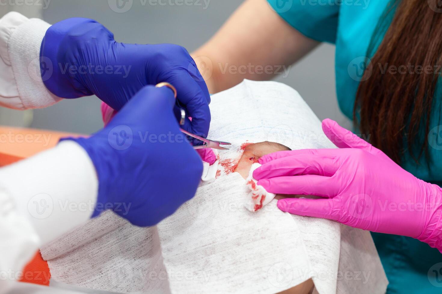 Doctor suturing a patient during a small surgery. Dermatologist carrying out a removal of benign skin lesion on the face of a young male patient. photo