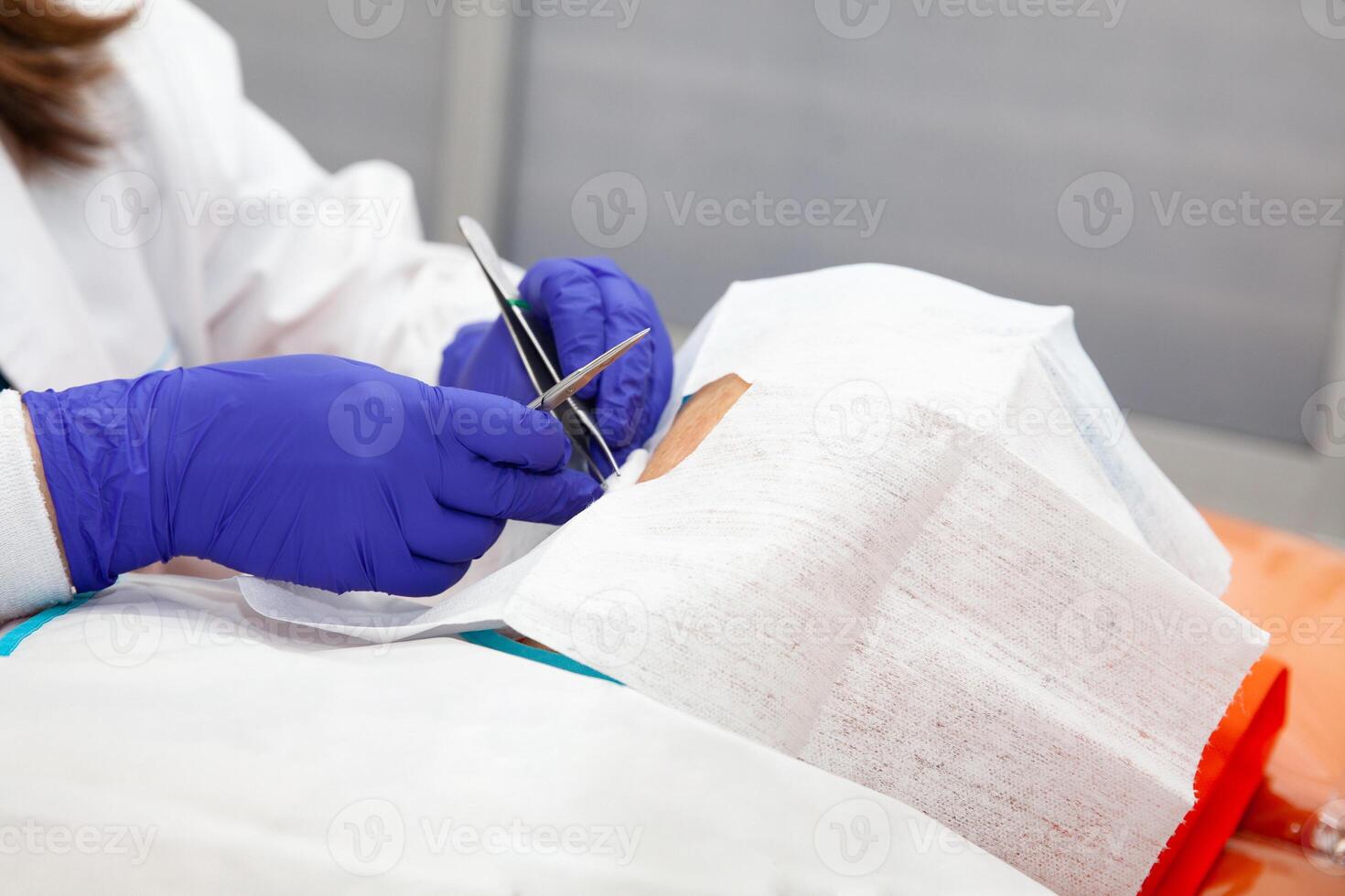 Dermatologist carrying out a skin biopsy on the face of a senior adult patient photo