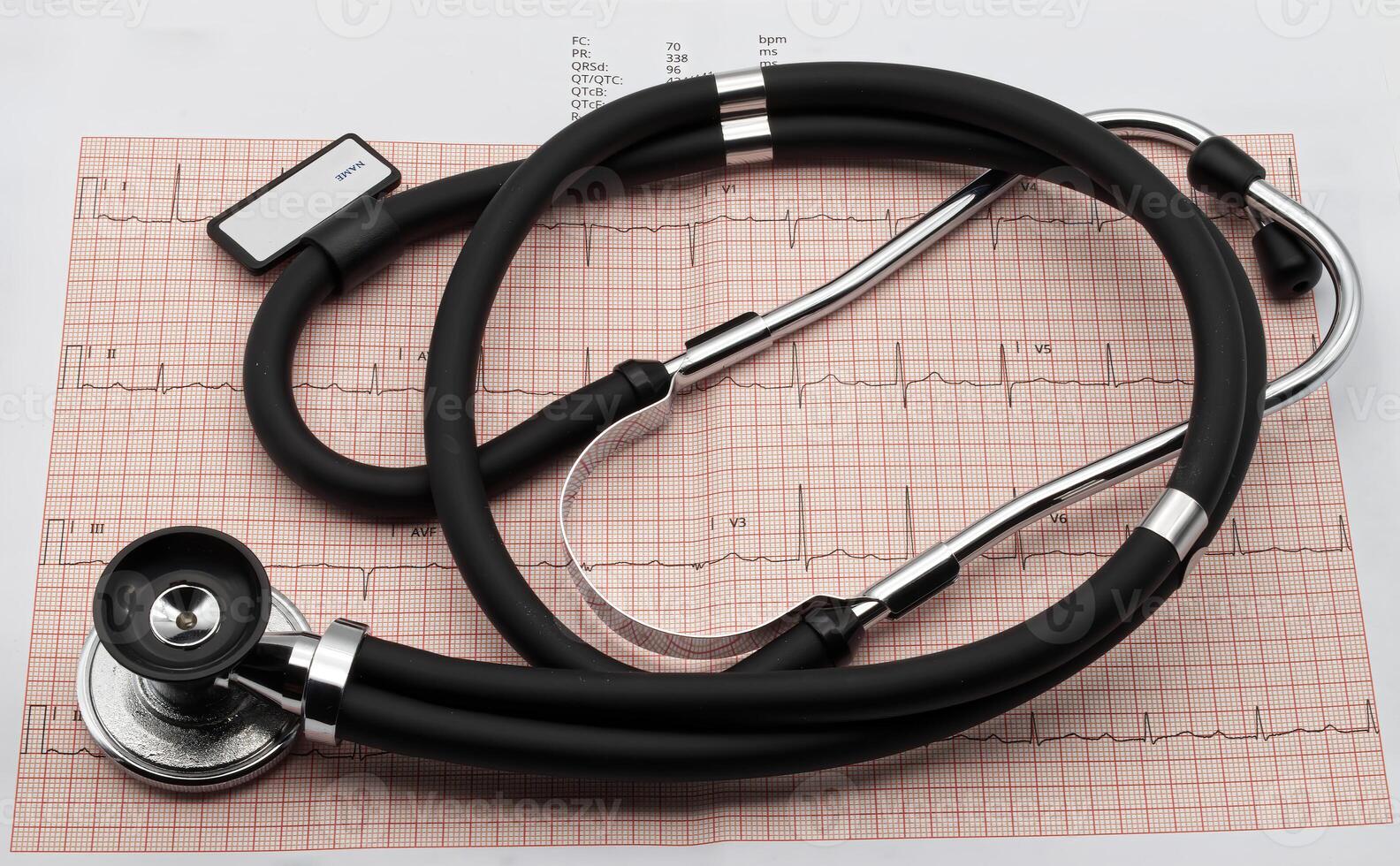 Stethoscope on electrocardiogram in paper form. Heart disease prevention. photo
