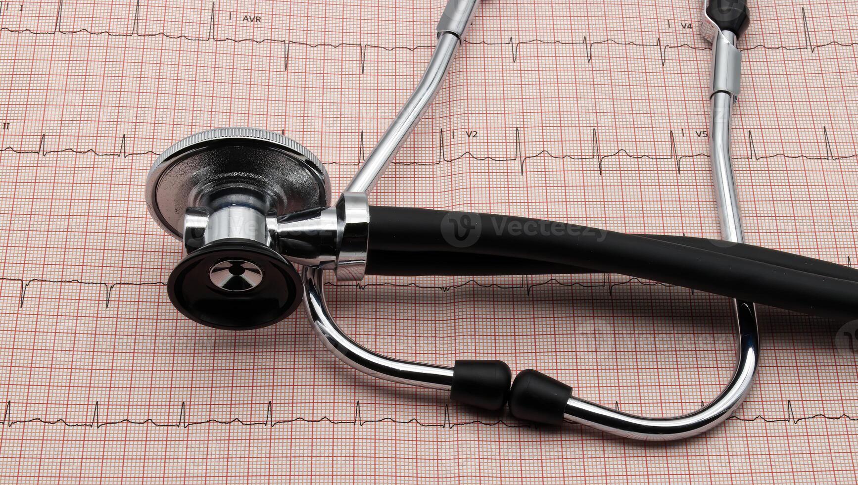 Stethoscope on electrocardiogram in paper form. photo
