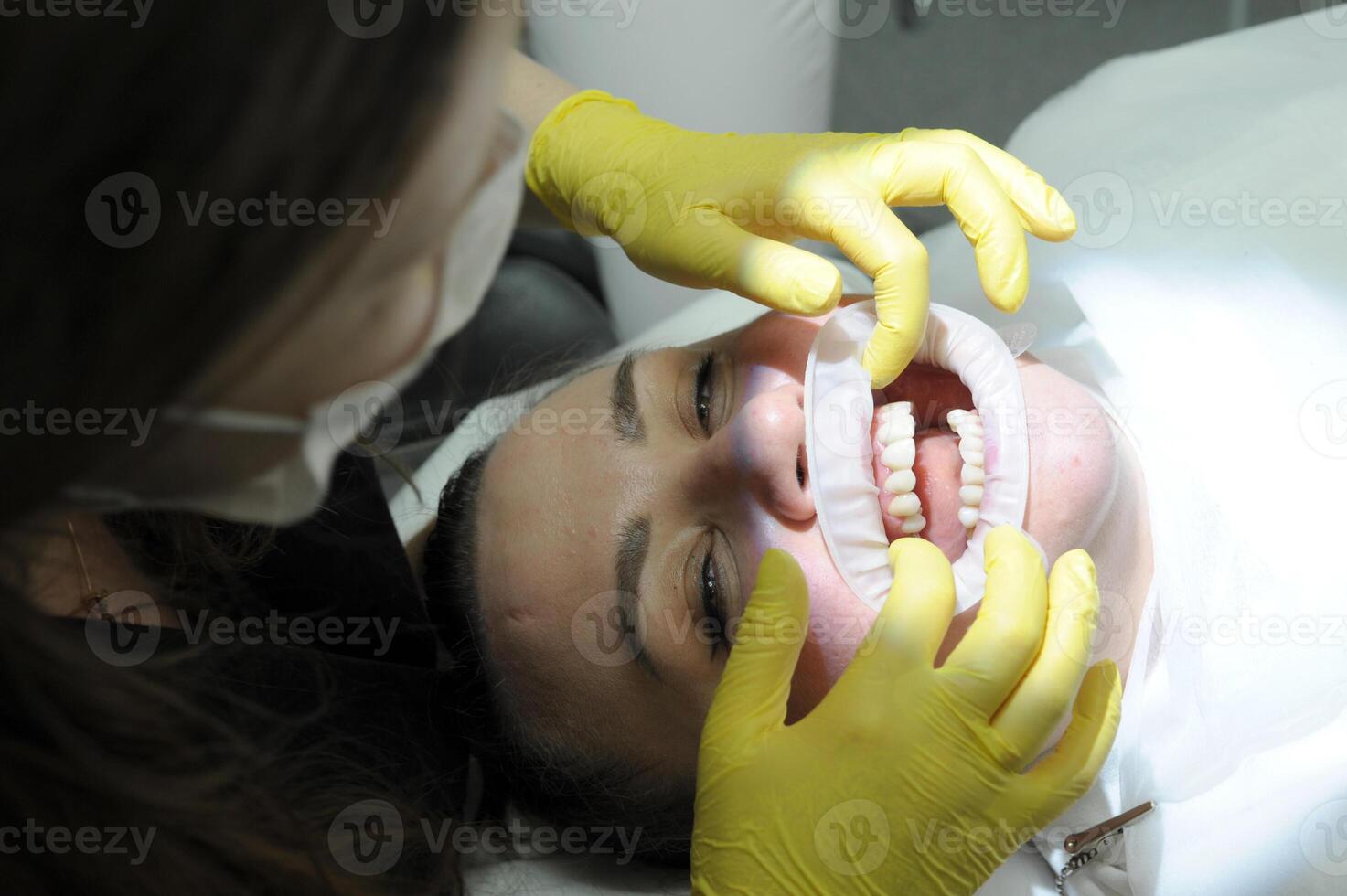 Dentist Closeup woman patient. Carious tooth treatment at dental clinic office. Nurse, doctor hand. Dentist making teeth cleaning, treating and canal filling. assistant spaying mouth photo