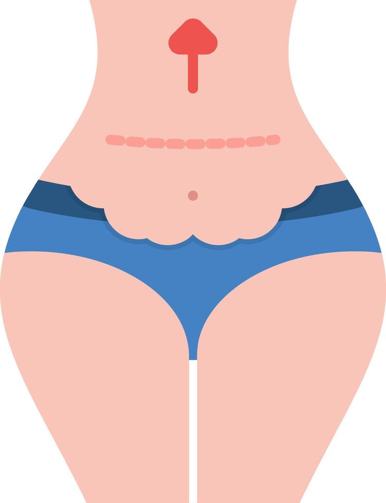 Abdominoplasty Flat Icon vector