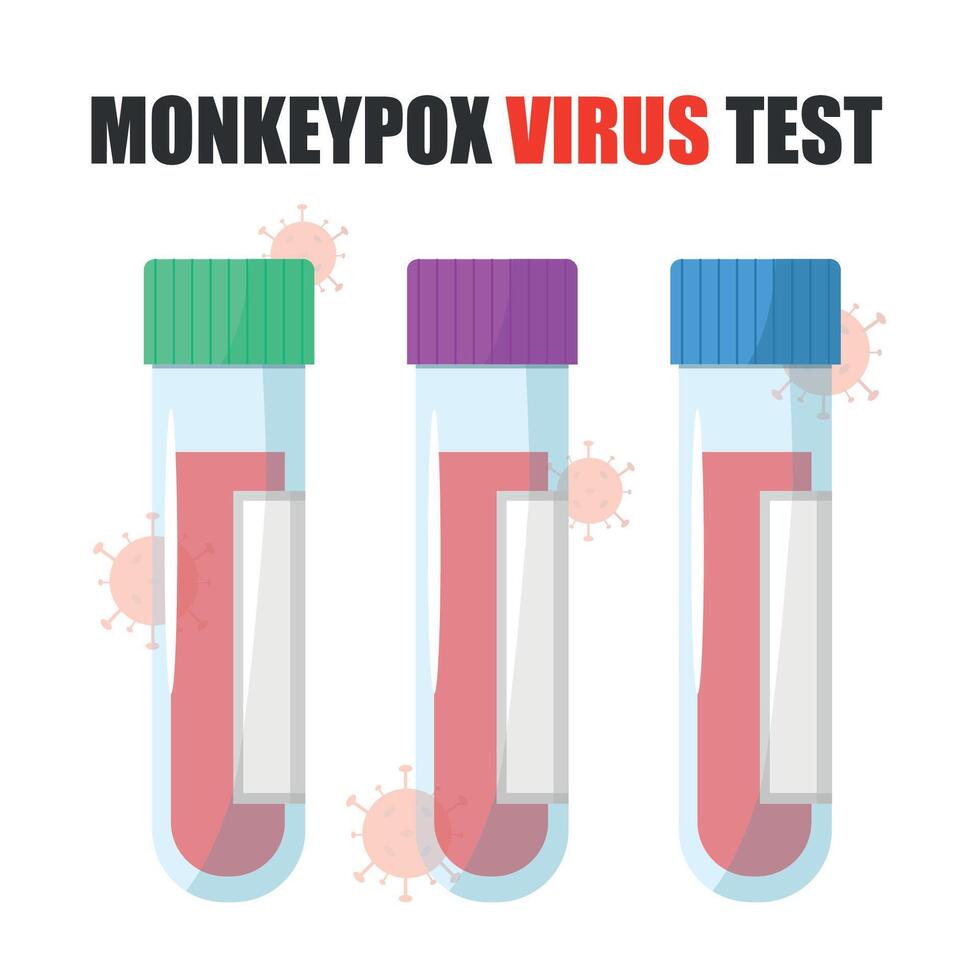 Blood samples in test tubes for monkeypox virus analysis. Blood test. vector