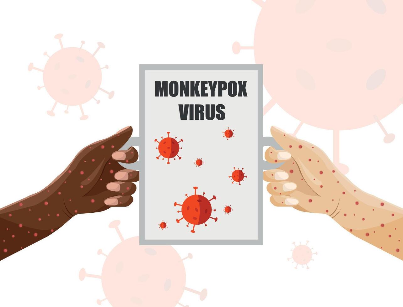 Banner about monkeypox virus. Warning about the virus. People's hands are covered with rash. vector
